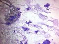 CytologicallyYoursUnknowns201312-3-01.jpg