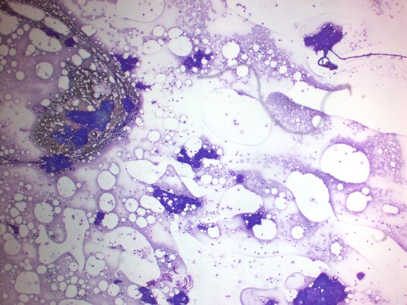 File:CytologicallyYoursUnknowns201312-3-01.jpg