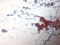 CytologicallyYoursUnknowns201310-1-01.jpg