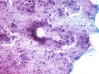 CytologicallyYoursUnknowns201310-5-06.jpg