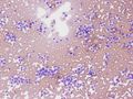 CytologicallyYoursUnknowns201311-5-01.jpg