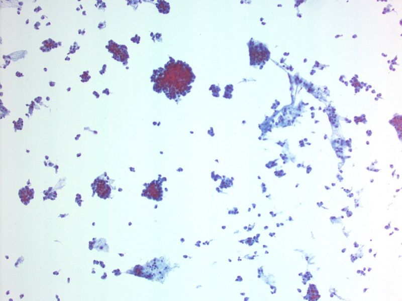 File:CytologicallyYoursUnknowns201312-1-01.jpg