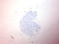 CytologicallyYoursUnknowns201310-3-12.jpg