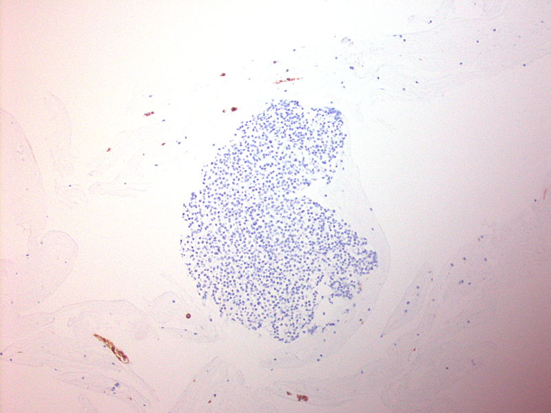 File:CytologicallyYoursUnknowns201310-3-12.jpg