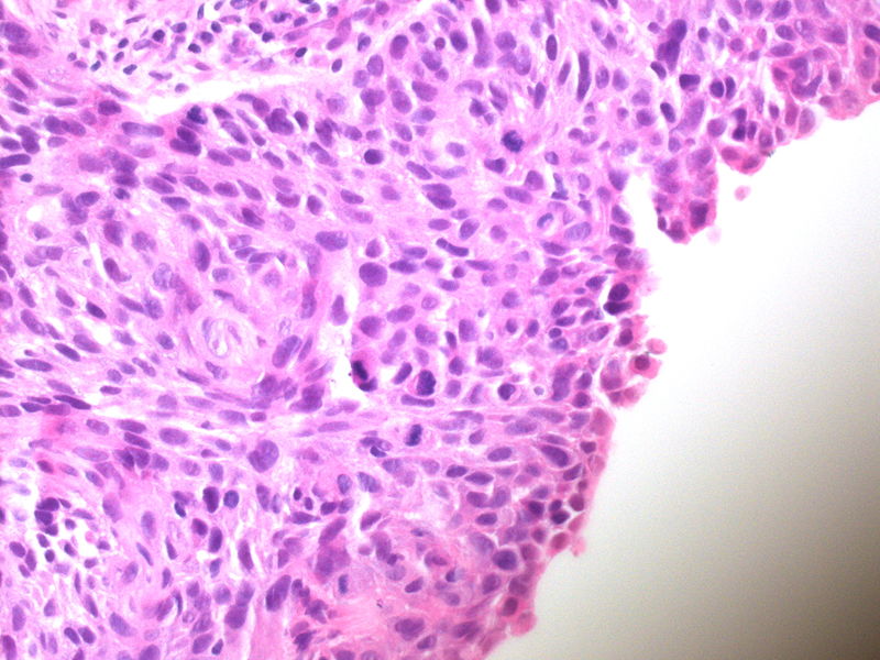 File:CytologicallyYoursUnknowns201310-4-08.jpg