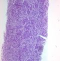 CytologicallyYoursUnknowns201312-1-04.jpg