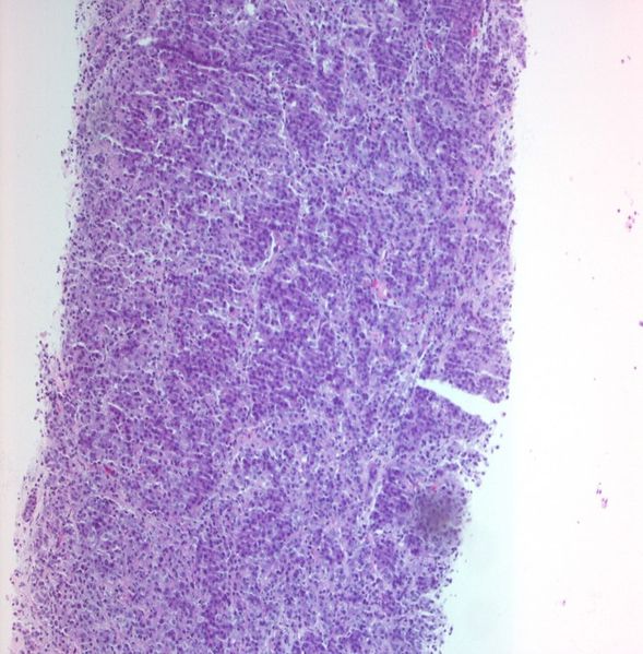 File:CytologicallyYoursUnknowns201312-1-04.jpg