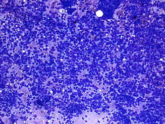 CytologicallyYoursUnknowns201401-04-01.jpg