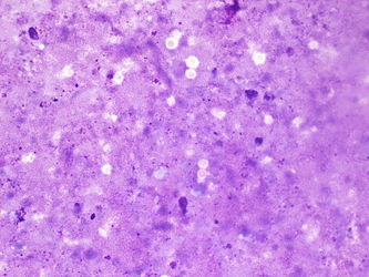 CytologicallyYoursUnknowns201310-5-04.jpg