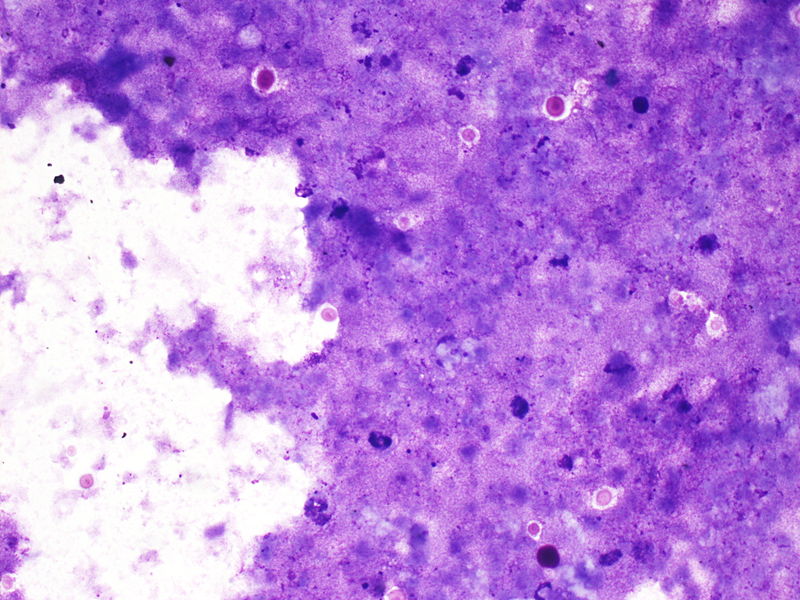 File:CytologicallyYoursUnknowns201310-5-02.jpg