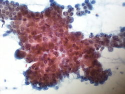 CytologicallyYoursUnknowns201310-1-03.jpg