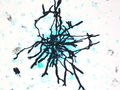 CytologicallyYoursUnknowns201310-6-06.jpg