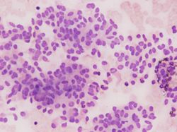 CytologicallyYoursUnknowns201311-4-02.jpg