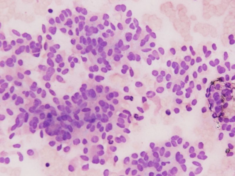 File:CytologicallyYoursUnknowns201311-4-02.jpg