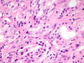 CytologicallyYoursCoW20131111Biopsy5.jpg