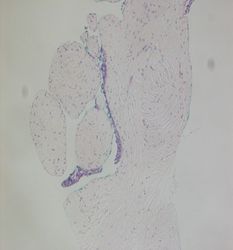 CytologicallyYoursUnknowns201312-3-07.jpg