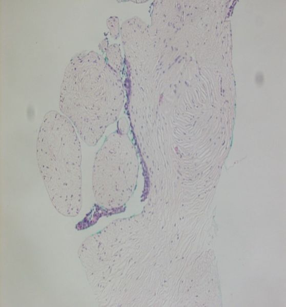 File:CytologicallyYoursUnknowns201312-3-07.jpg