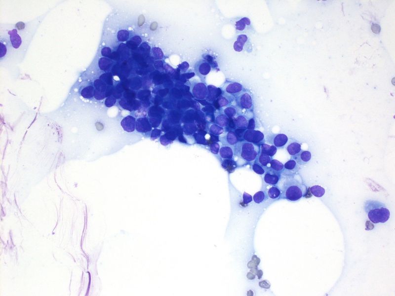 File:CytologicallyYoursUnknowns201312-5-02.jpg