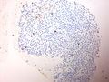 CytologicallyYoursUnknowns201310-3-11.jpg