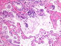 CytologicallyYoursCoW20131118Biopsy3.jpg