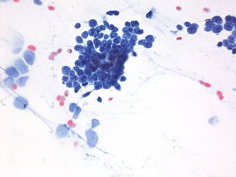 CytologicallyYoursUnknowns201310-2-08.jpg