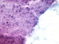 CytologicallyYoursUnknowns201310-5-07.jpg