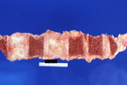 00009651