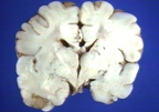 00204366