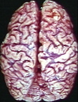 00237215